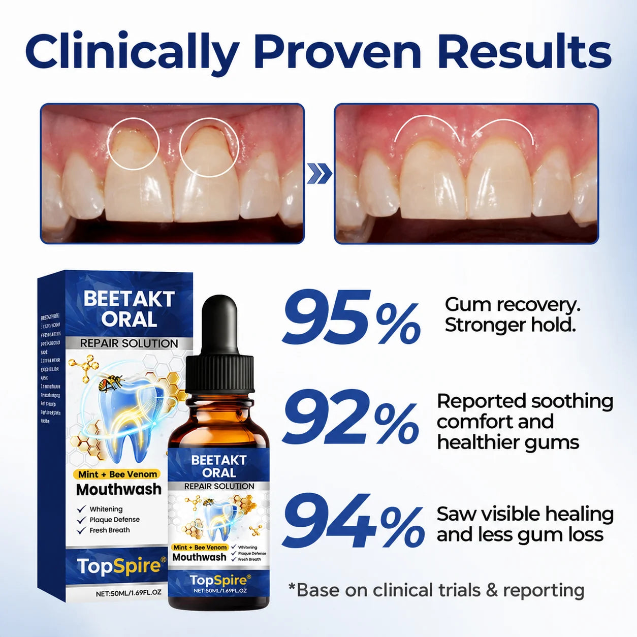 TopSpire® BeeTakt Oral Repair Solution✨