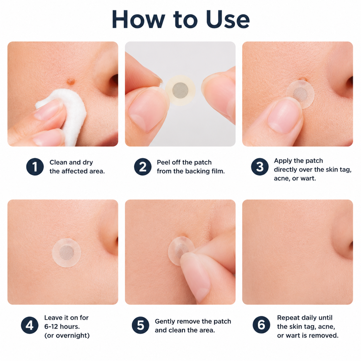 ✨Soulhera®2-in-1 Microneedle & Hydrocolloid Patch🍀| Removes Raised Moles, Acne, Flat Warts & Skin Tags | Helps Improve Wrinkles, Scars & Blemishes | Invisible Patches for Face & Body