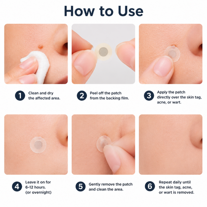 ✨Soulhera®2-in-1 Microneedle & Hydrocolloid Patch🍀| Removes Raised Moles, Acne, Flat Warts & Skin Tags | Helps Improve Wrinkles, Scars & Blemishes | Invisible Patches for Face & Body