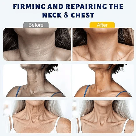 ✨Instant Neck Lift Cream — Infused with Retinol & Hyaluronic Acid | Firms the Neck, Reduces Wrinkles