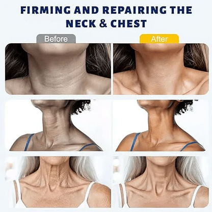 ✨Instant Neck Lift Cream — Infused with Retinol & Hyaluronic Acid | Firms the Neck, Reduces Wrinkles