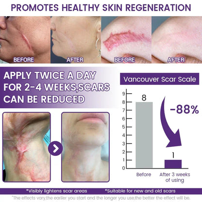 TopSpire® ReGenScar Stem Cell Scar Gel
