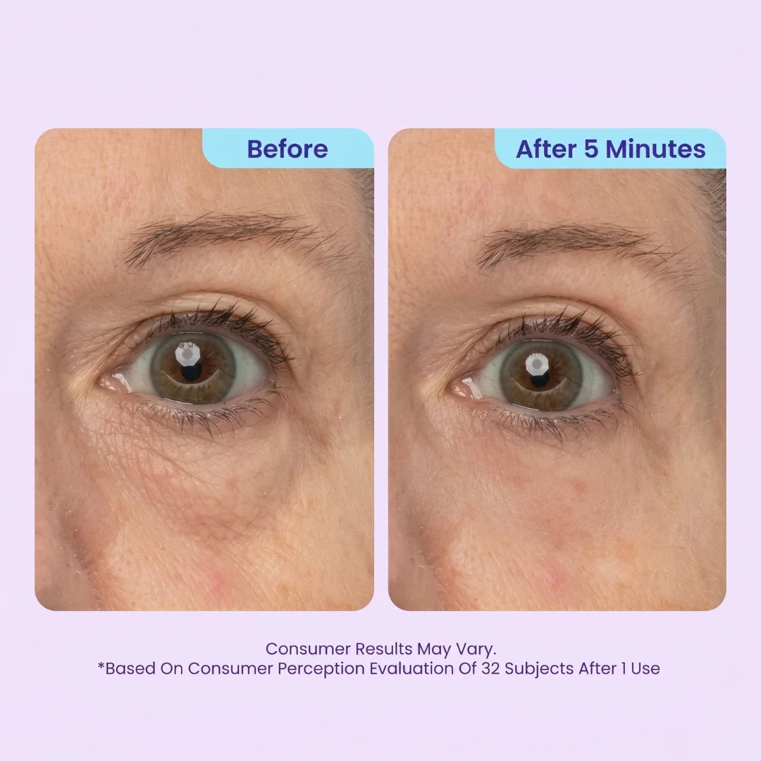 TopSpire™ Instant Lift Eye Gel | For Puffiness & Bags, Wrinkles, Fine Lines and Dark Circles