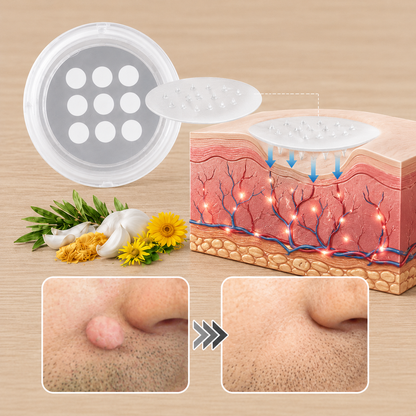 ✨Soulhera®2-in-1 Microneedle & Hydrocolloid Patch🍀| Removes Raised Moles, Acne, Flat Warts & Skin Tags | Helps Improve Wrinkles, Scars & Blemishes | Invisible Patches for Face & Body