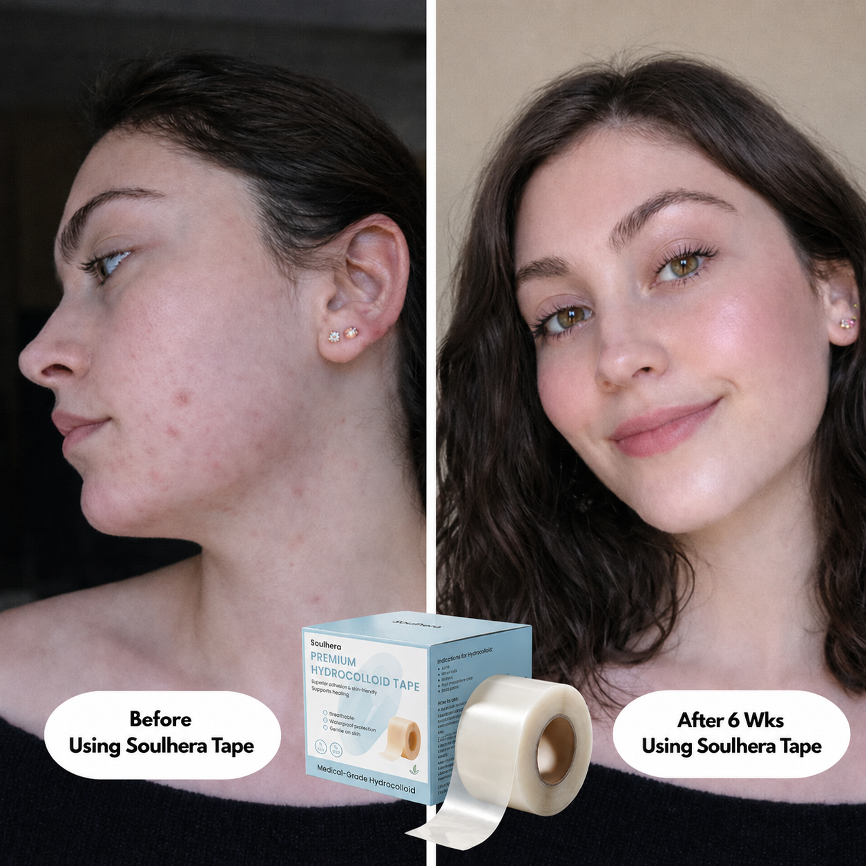 SOULHERA Premium Hydrocolloid Roll That Heals & Protects Your Skin