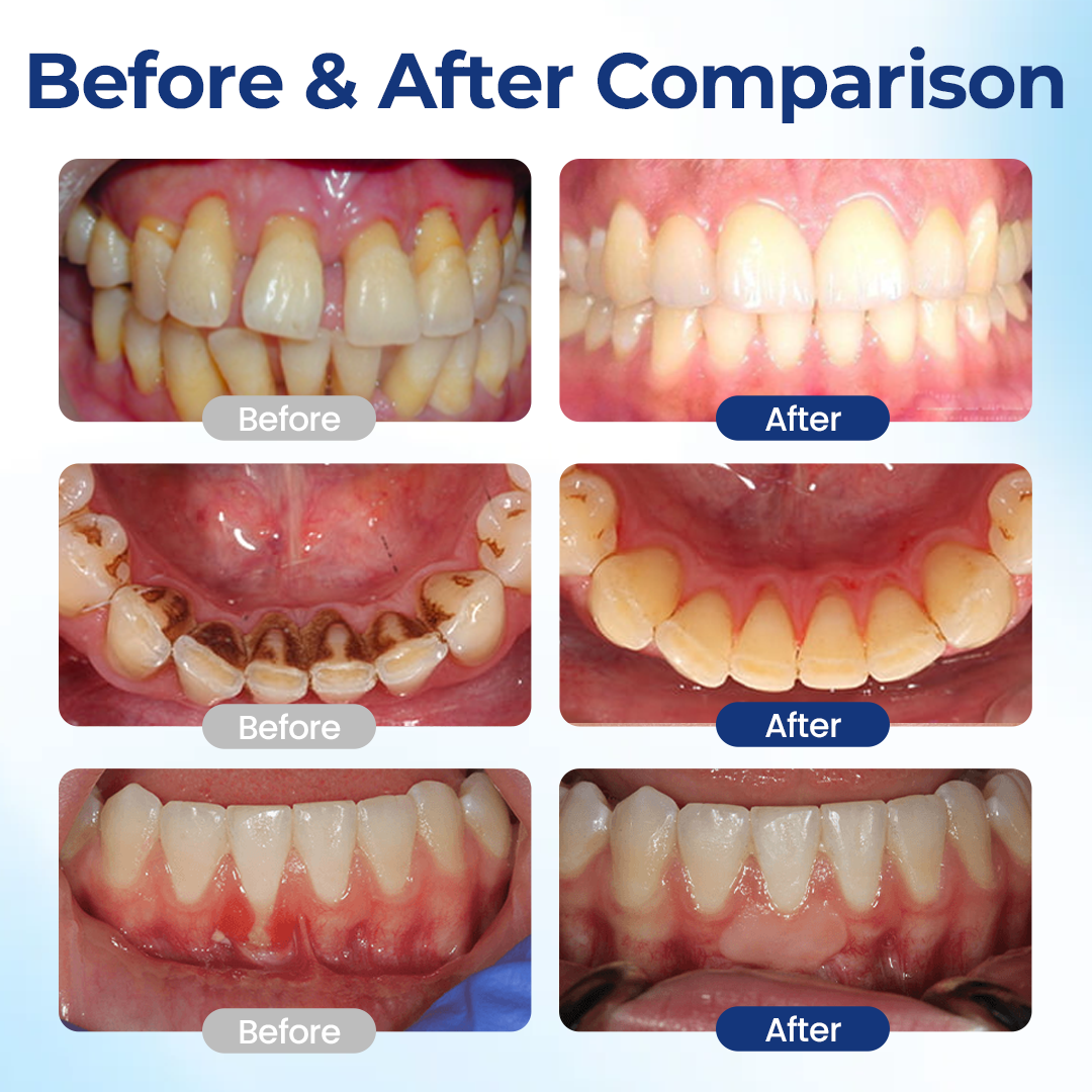 TopSpire® BeeTakt Oral Repair Solution✨