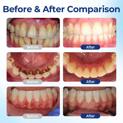 TopSpire® BeeTakt Oral Repair Solution✨