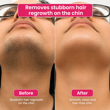 🔥LAST DAY 60% OFF  Soulhera Hair Reduction Oil 60 ml – Permanent Hair Removal Oil