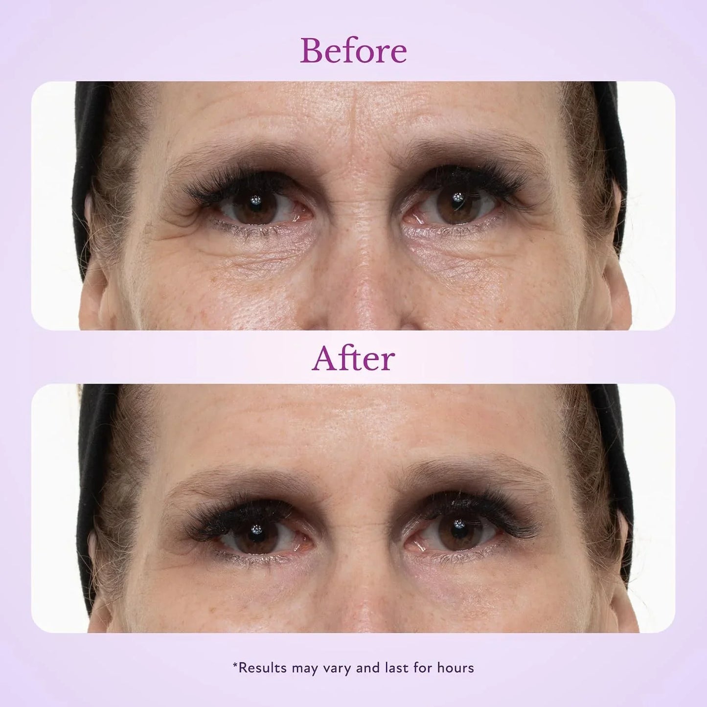 Suiiao 60 Second Effects Tinted Firming Gel - Under Eye Cream For Puffiness And Bags Under Eyes