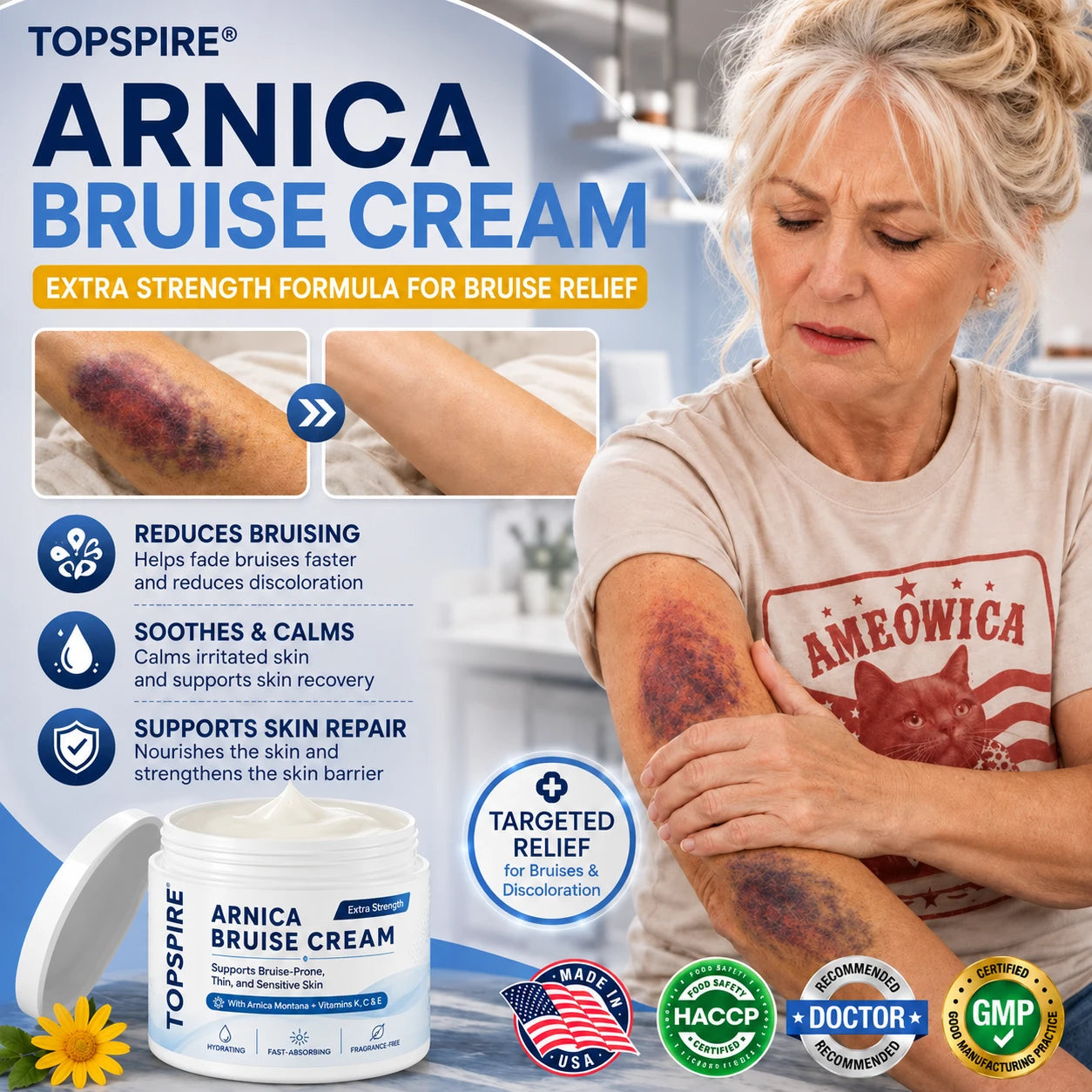 💥75K+ SOLD💕 TOPSPIRE® Arnica Bruise Cream - Repair Bruises & Strengthen Fragile Skin