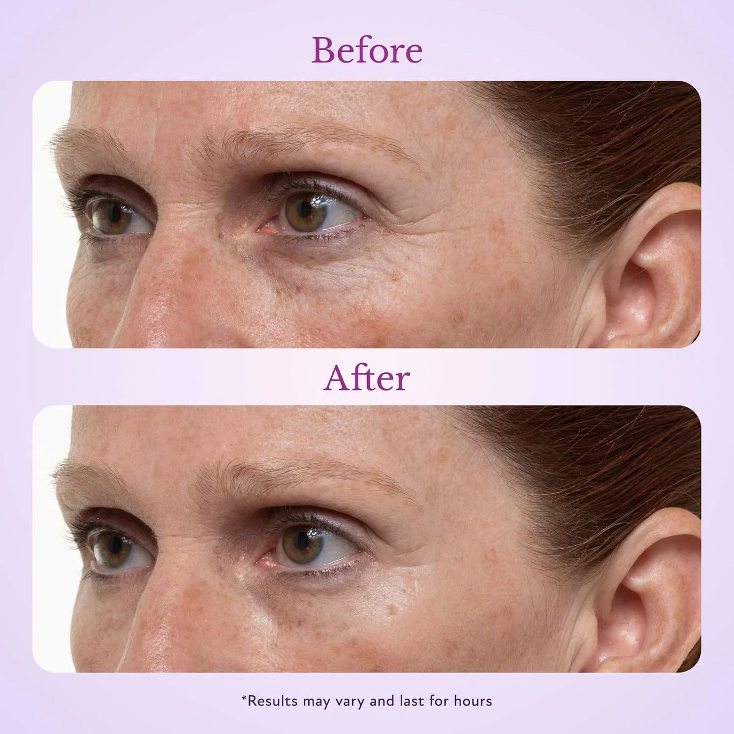 Suiiao 60 Second Effects Tinted Firming Gel - Under Eye Cream For Puffiness And Bags Under Eyes