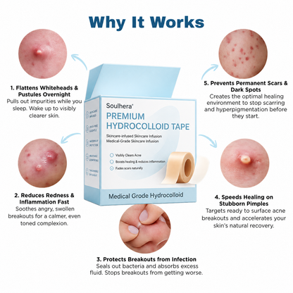 SOULHERA Premium Hydrocolloid Roll That Heals & Protects Your Skin
