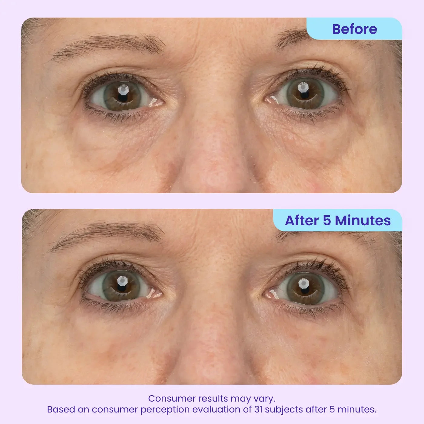 Soulhera Eye Bag Instant Eraser, Tightens, Firms, & Blurs Wrinkles