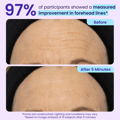 Soulhera Eye Bag Instant Eraser, Tightens, Firms, & Blurs Wrinkles