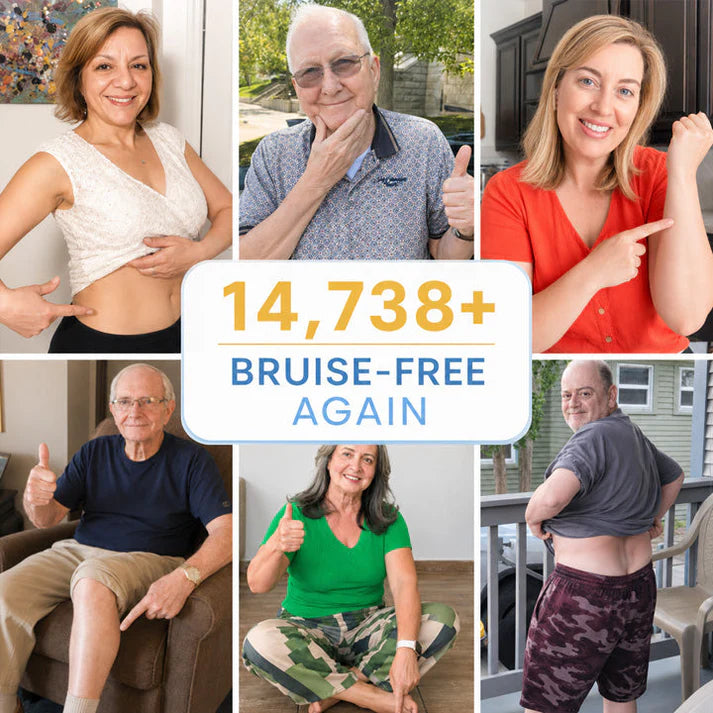 💥75K+ SOLD💕 TOPSPIRE® Arnica Bruise Cream - Repair Bruises & Strengthen Fragile Skin
